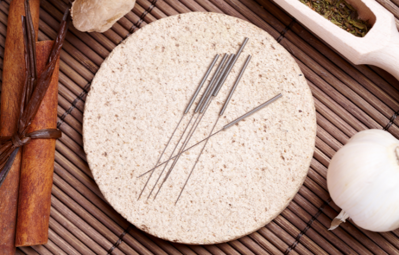 Alleviate Anxiety and Stress with Acupuncture