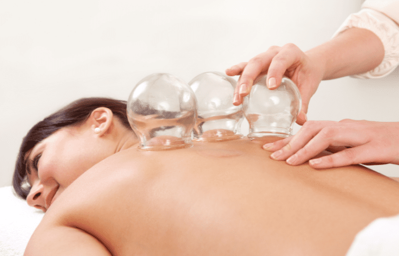 Cupping and Chinese herbs for headache pain relief