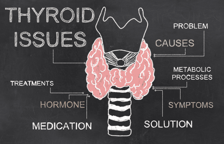 hashimotos thyroid causes and treatment