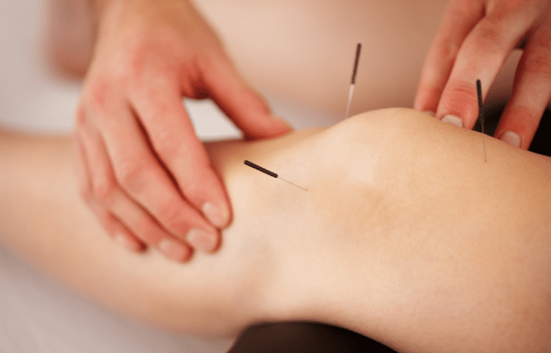 acupuncture near me herbs knee pain management osteoarthritis of the knee 