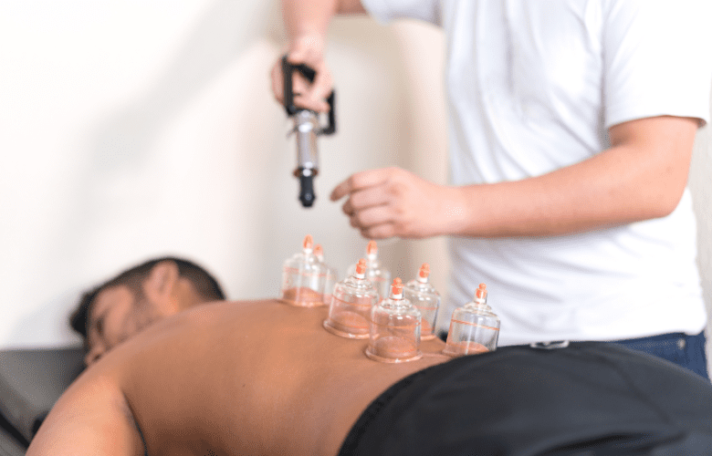cupping for sciatica pain relief healing points acupuncture near me dr. michelle iona wellness center riverhead pain management acupuncturist